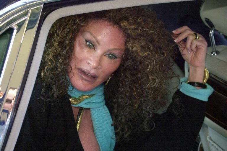 Jocelyn Wildenstein, ‘Catwoman’ socialite known for her extreme cosmetic surgery, dies